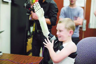 德國(guó)研究人員為戰(zhàn)區(qū)傷員開(kāi)發(fā)低成本3D打印假肢