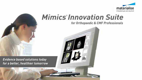 Materialise 發(fā)布新版Mimics軟件