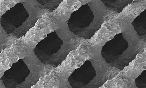 德國首例3D打印鈦脊柱成功融合植入手術(shù)