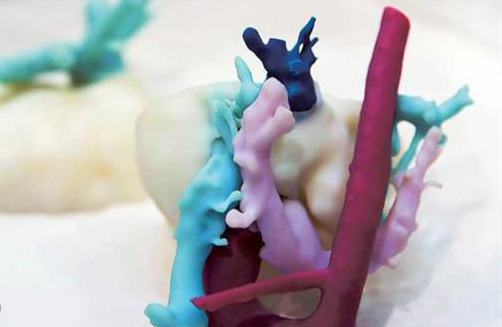 迪拜計劃在所有醫(yī)院中應(yīng)用3D打印技術(shù)