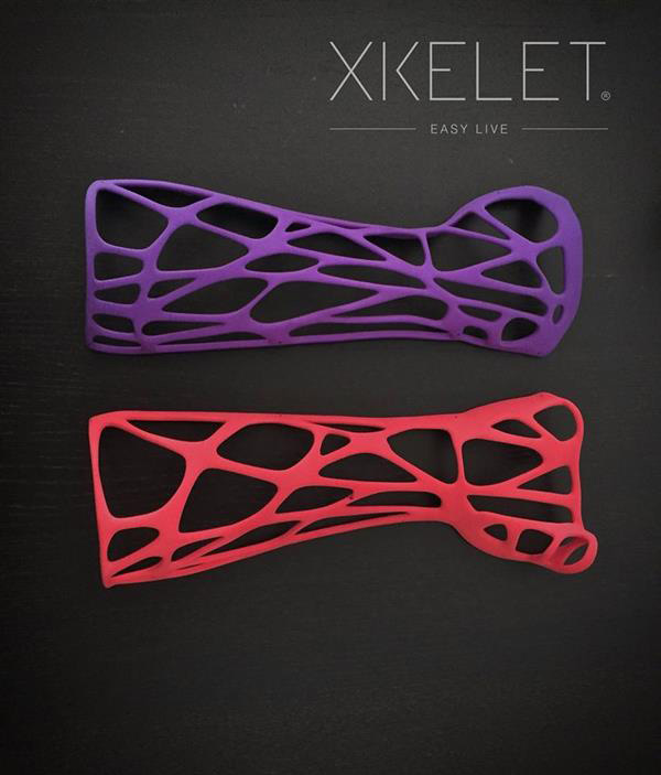 兼具舒適性和功能性的3D打印骨折固定夾板