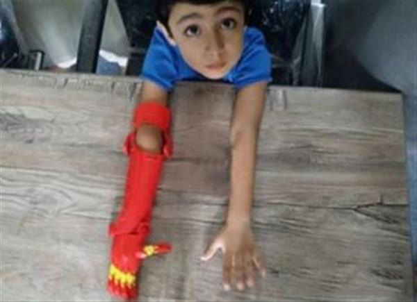 Bioniks為孩子們3D打印假肢“超級(jí)英雄”系列假肢