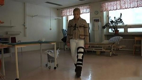 3D打印髖關(guān)節(jié)植入物讓瑞典少女再次行走