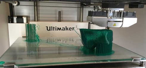 西班牙醫(yī)院為推動(dòng)醫(yī)學(xué)發(fā)展引進(jìn)3D打印技術(shù)