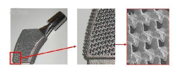 帶數(shù)百個(gè)小爪的新3D打印骨植入物使用壽命更長