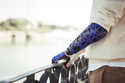 3D打印假體公司UNYQ在美國東海岸新增辦公點(diǎn)