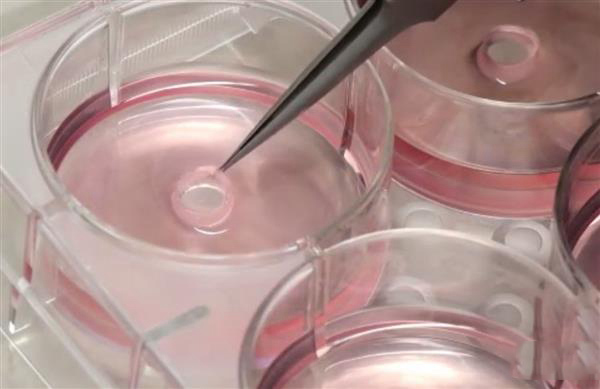 對(duì)抗心臟病的“環(huán)堆疊法”：用3D打印導(dǎo)板制作定制血管